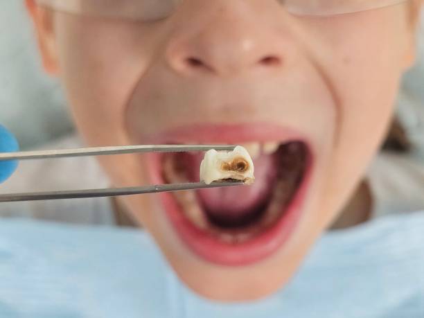 Best Same-Day Emergency Dentist in Barbourville, KY
